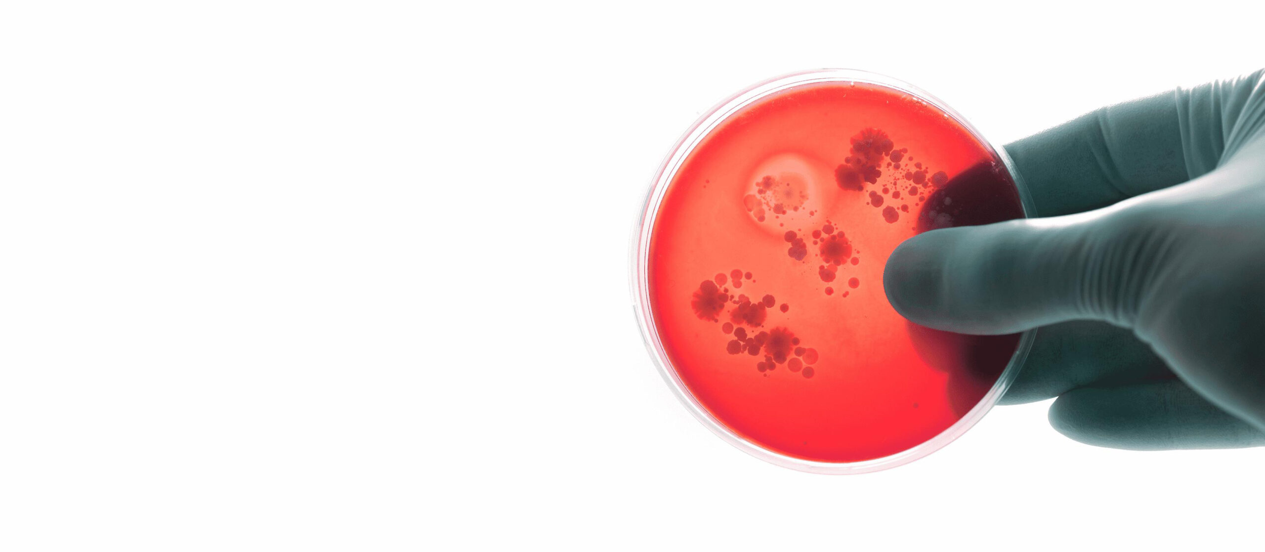 SSI Diagnostica Group